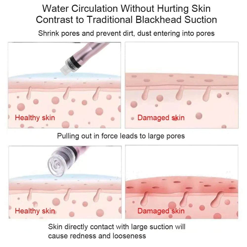 Portable oxygen spray hydro jet machine with bottle and crystal heads for blackhead removal and face cleansing