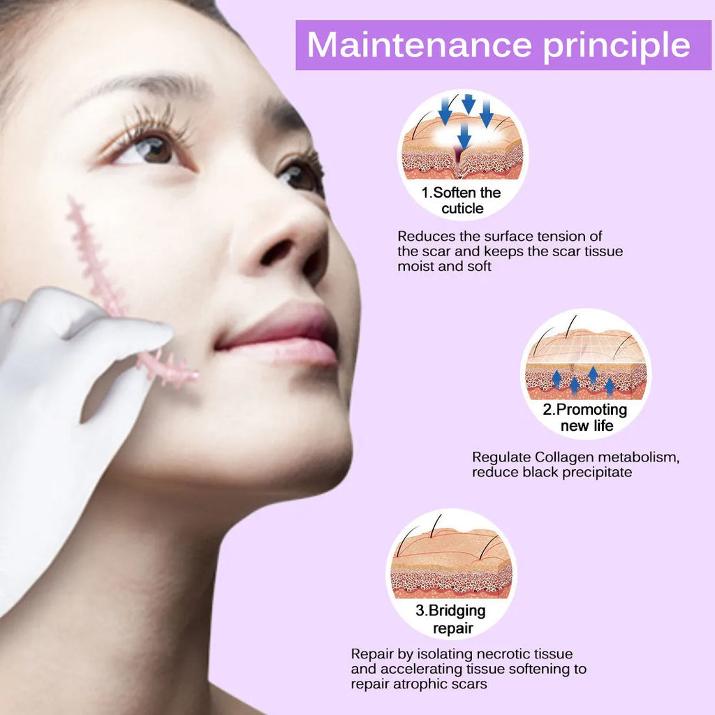Skin Rebound Scarless Cream 50g tube for face acne scar and stretch mark removal