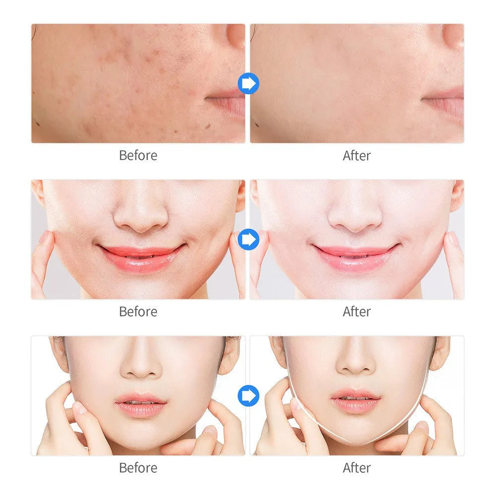 Pink ABS plasma beauty instrument with 1800mAh battery for home cleansing and acne rejuvenation.
