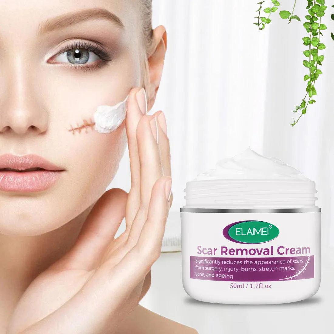 Skin Rebound Scarless Cream 50g tube for face acne scar and stretch mark removal