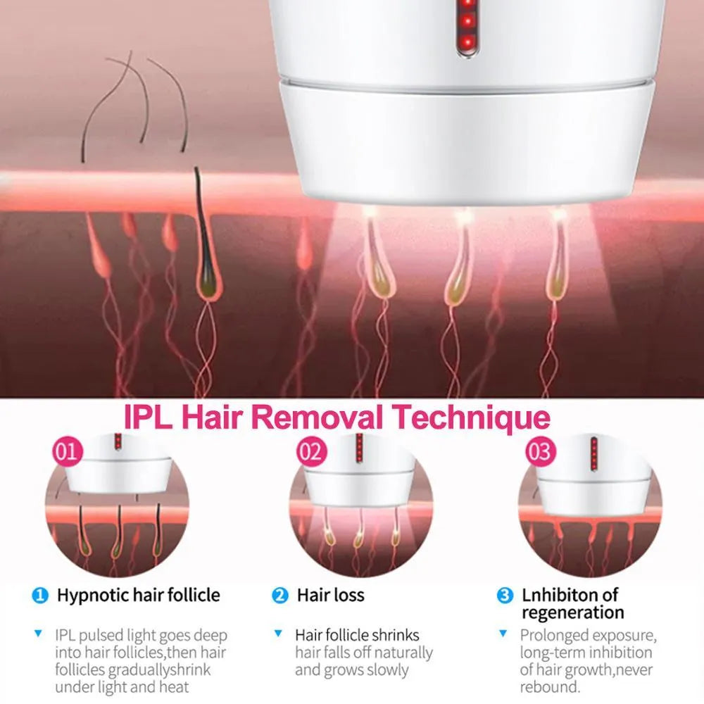 White home laser hair removal device with display screen and button for adjusting five energy levels.
