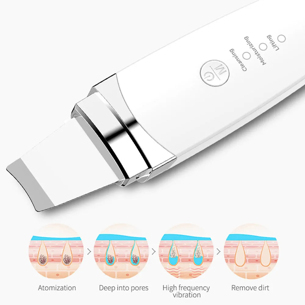 Ultrasonic peeling beauty instrument G77 white, 183.5 mm long, with stainless steel shovel head and USB charging cable