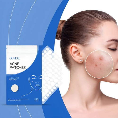 Pack of 216 transparent hydrocolloid acne patches for spot treatment with tea tree oil and vitamin E.