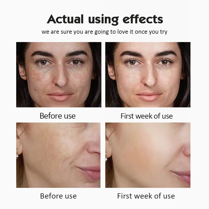Moisturizing Firming Liquid High Concentration Vitamin Serum Set in 2ml sachets with Nicotinamide and VC options