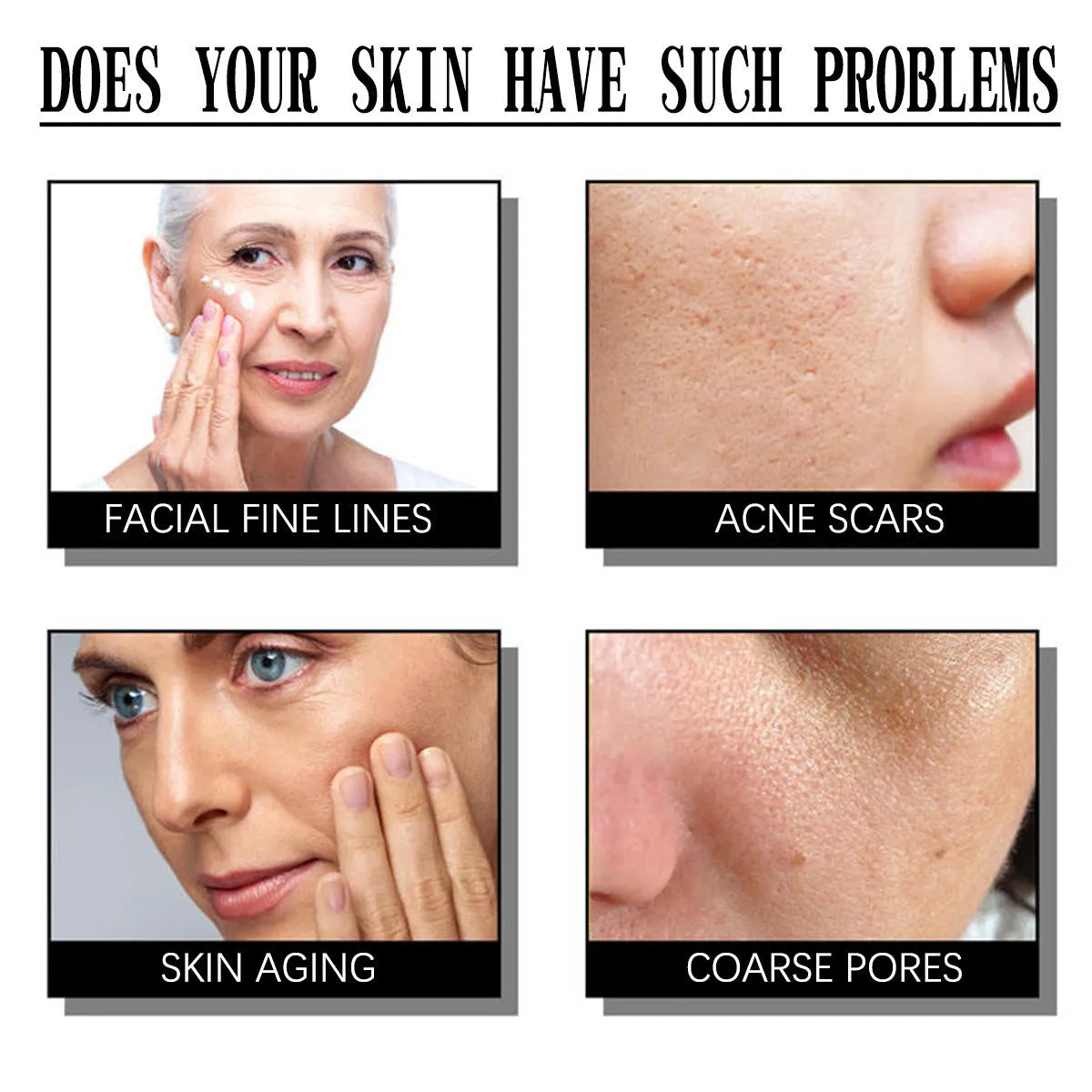 50g salicylate exfoliating moisturising cream in standard packaging