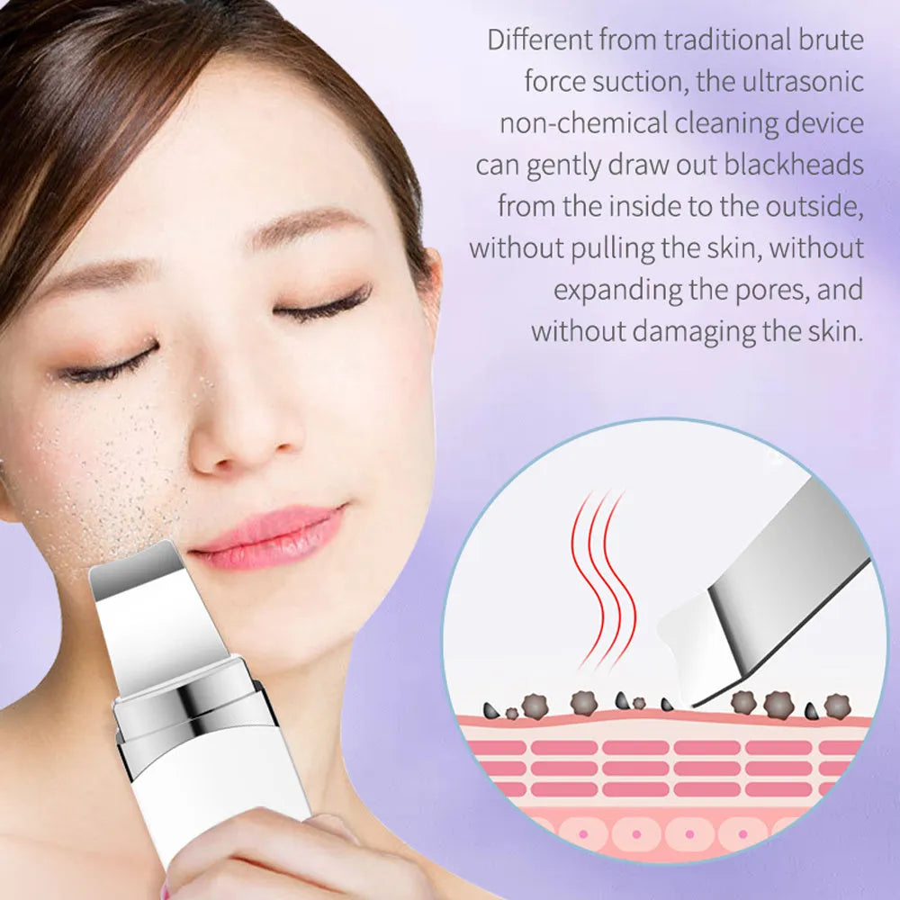 Ultrasonic peeling beauty instrument G77 white, 183.5 mm long, with stainless steel shovel head and USB charging cable