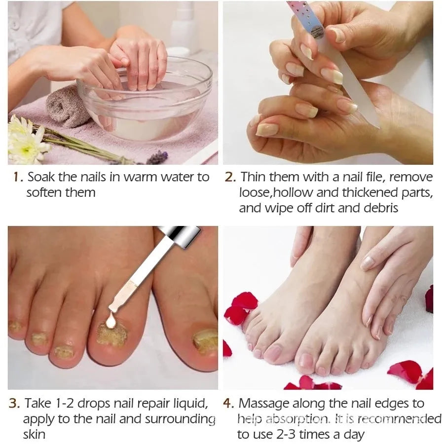 10ml whitening antibacterial liquid for foot care with universal skin type compatibility