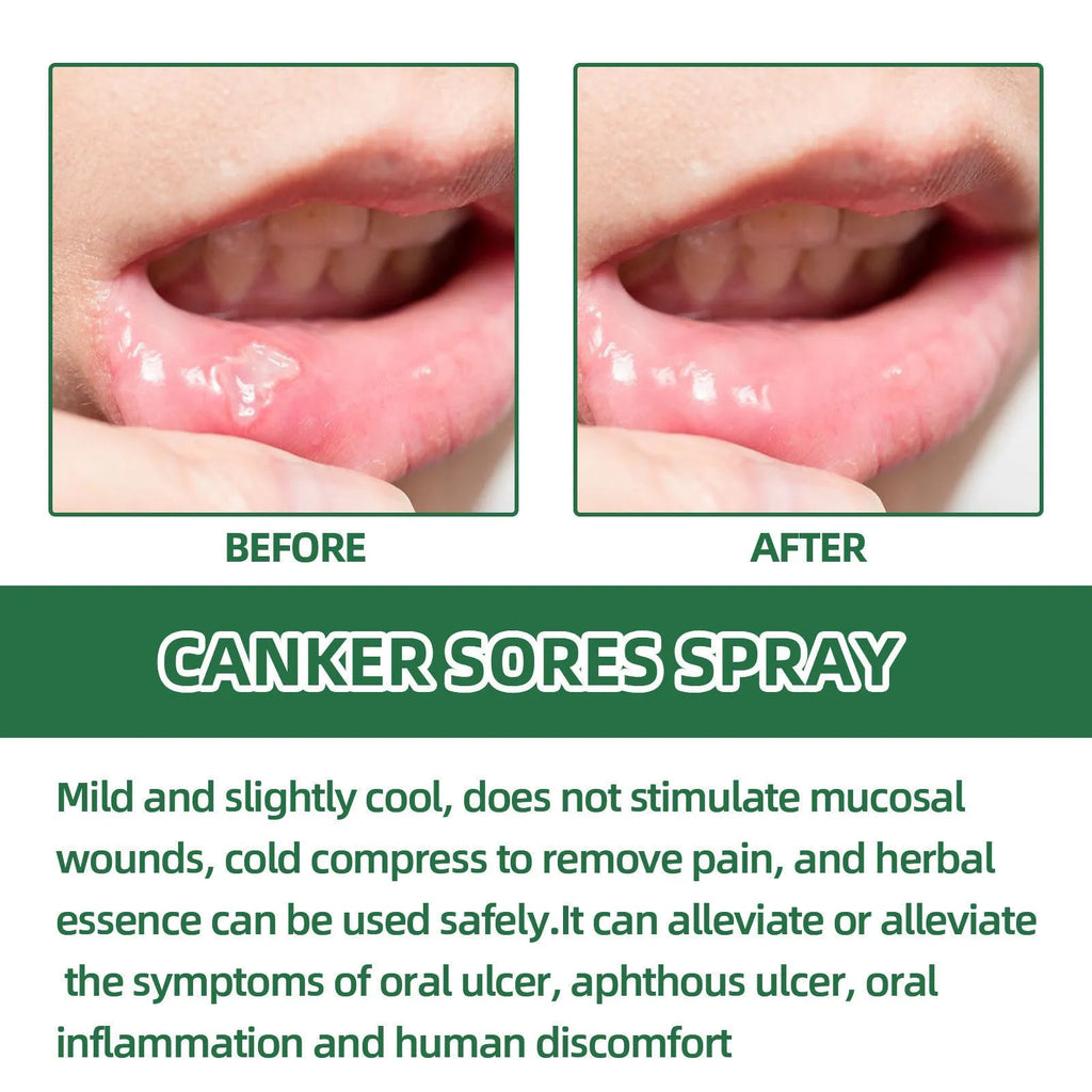Boxed 20ml mint breath freshener spray bottle for adult oral care.