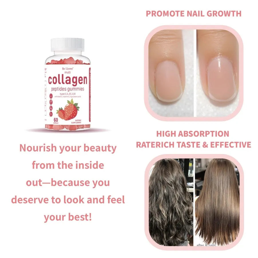 Collagen Peptide Gummies 4-pack white colour gummy supplements UK made skin hair nails joint support with Vitamin C and Biotin