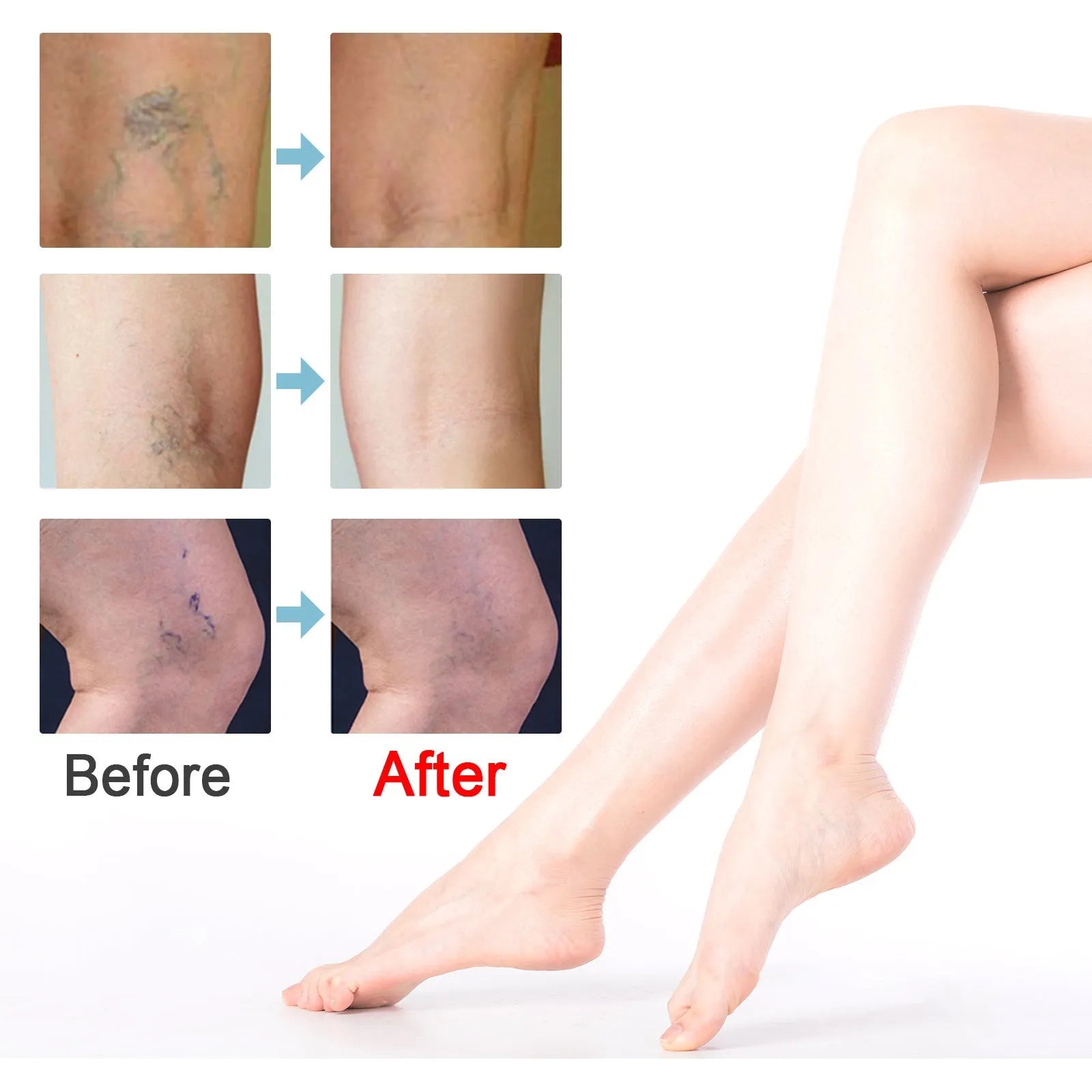 20g jar of vein repair cream for visible vein symptom relief