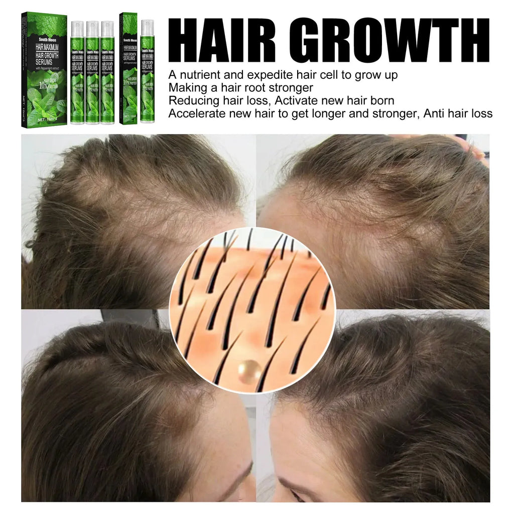 Mint Nutrition Nourishing Hair Growth Spray 10ml bottle for general hair types