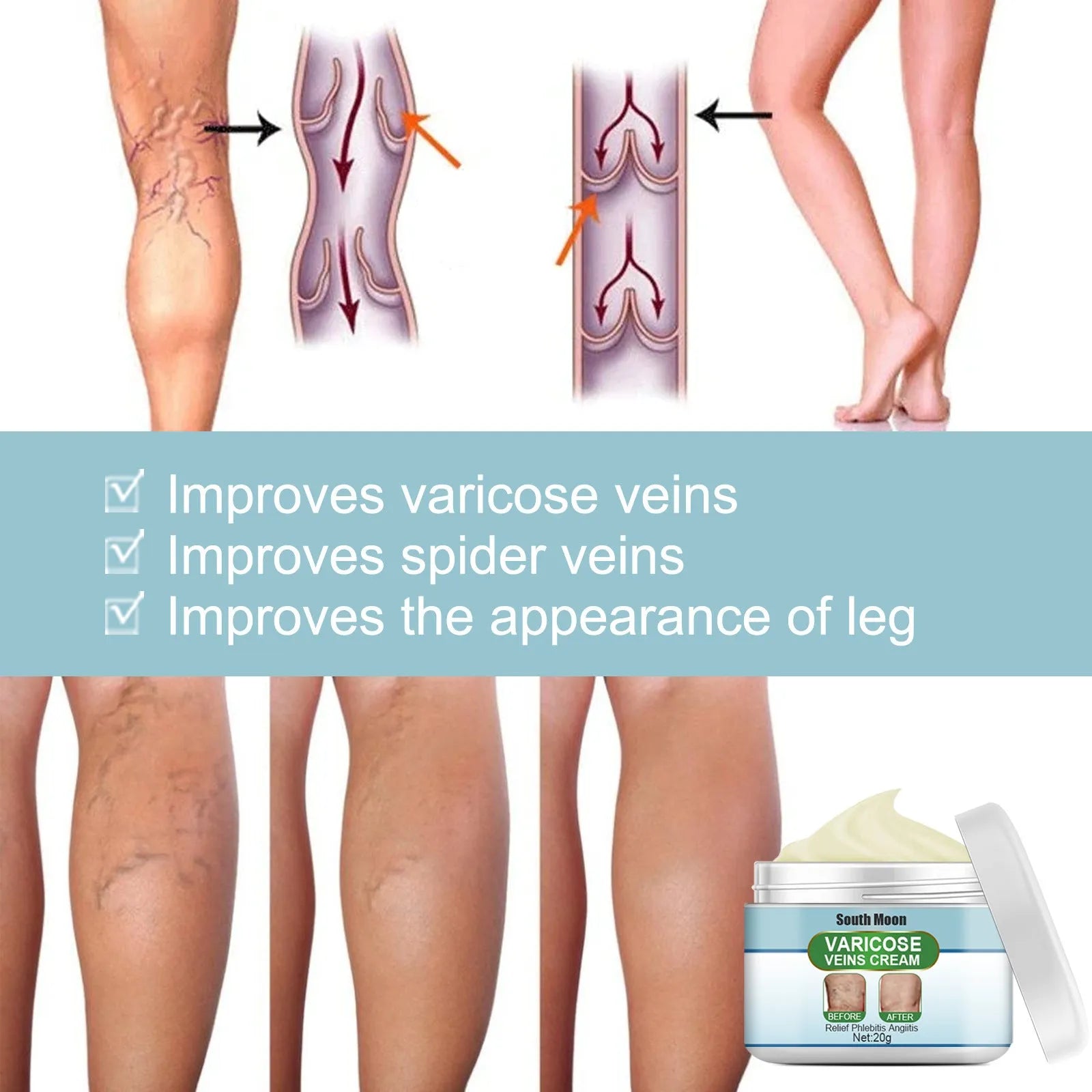 20g jar of vein repair cream for visible vein symptom relief