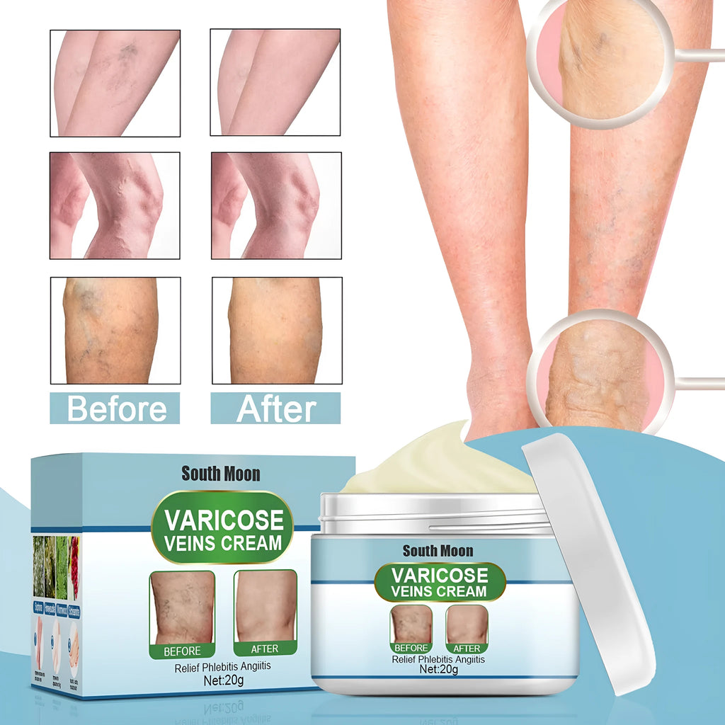 20g jar of vein repair cream for visible vein symptom relief