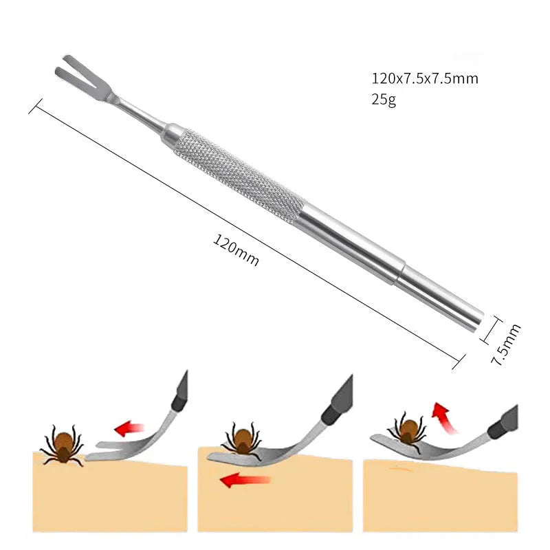 Stainless steel tick removal tweezers with pointed tips for pet tick extraction