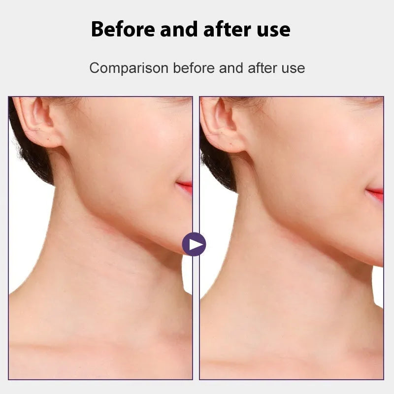 Skin tone neck contouring adhesive tape with V27 and V29 pattern options including strips and patches