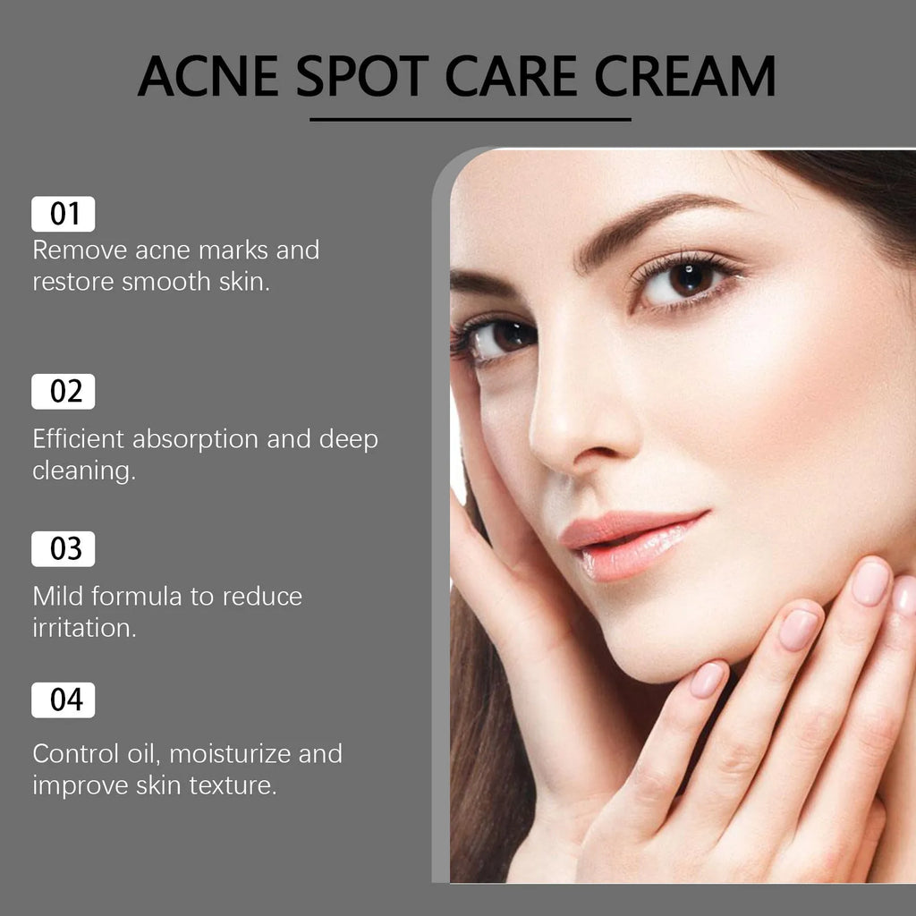 15g tube of acne cream with mint leaf and tea tree oil for facial spot treatment