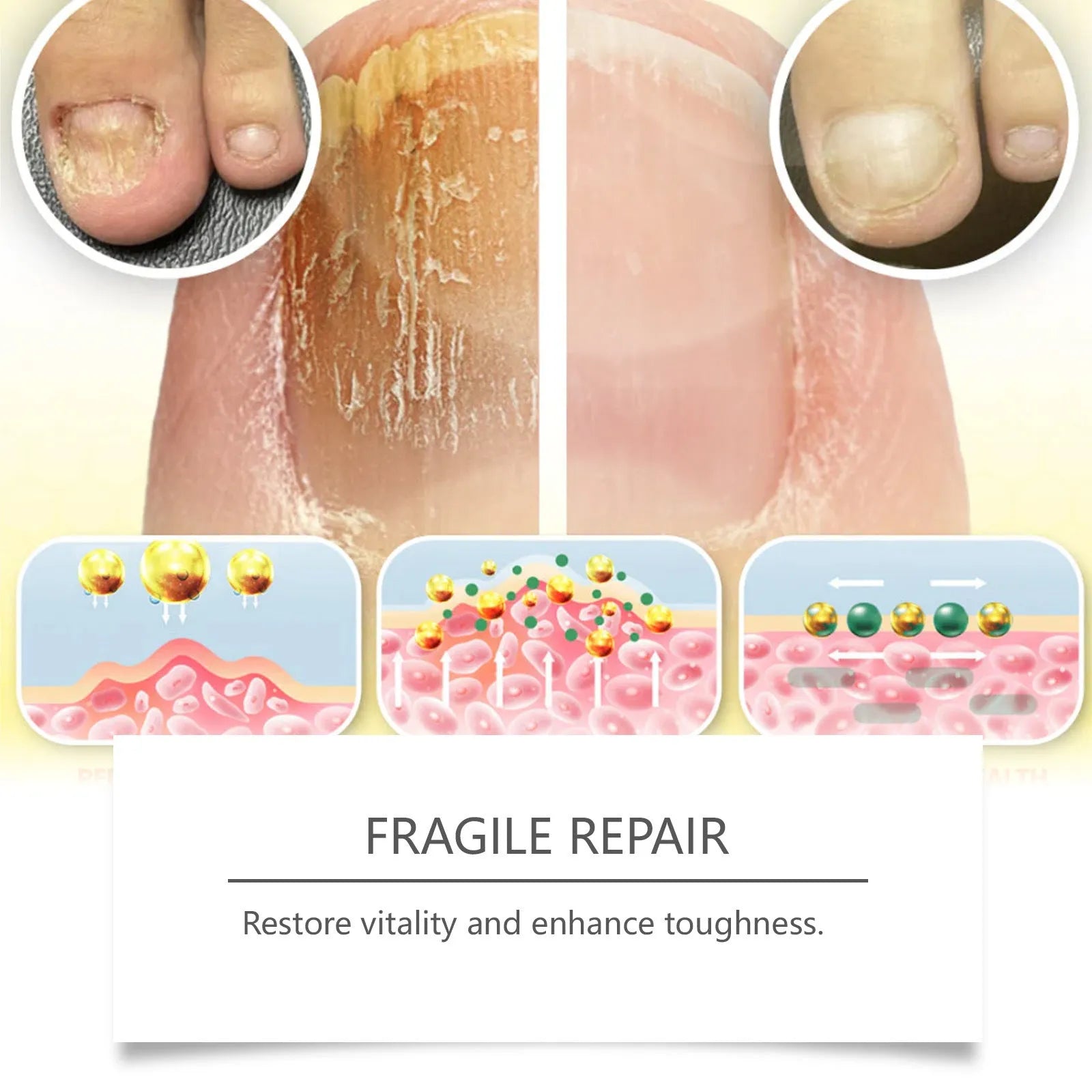 50ml nail fungus care solution bottle with bee venom and peppermint oil ingredients