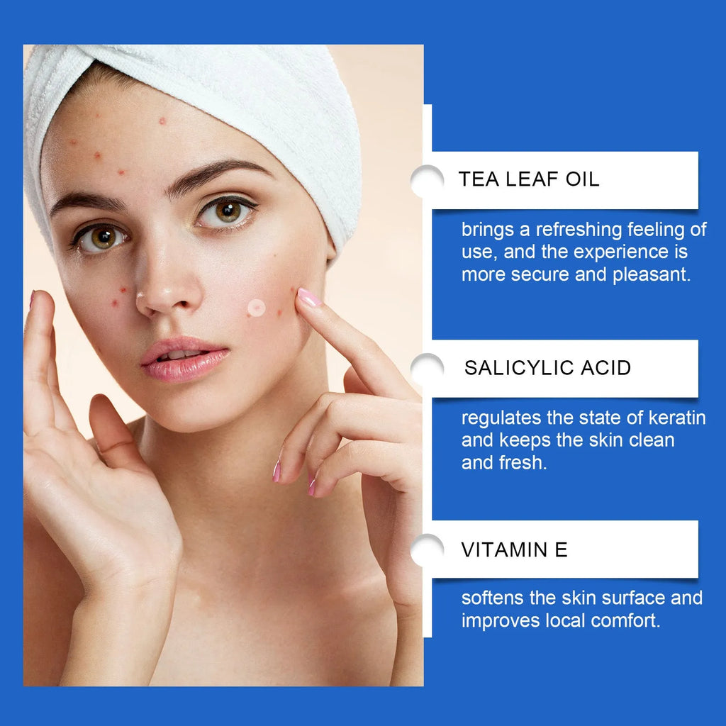 Pack of 216 transparent hydrocolloid acne patches for spot treatment with tea tree oil and vitamin E.