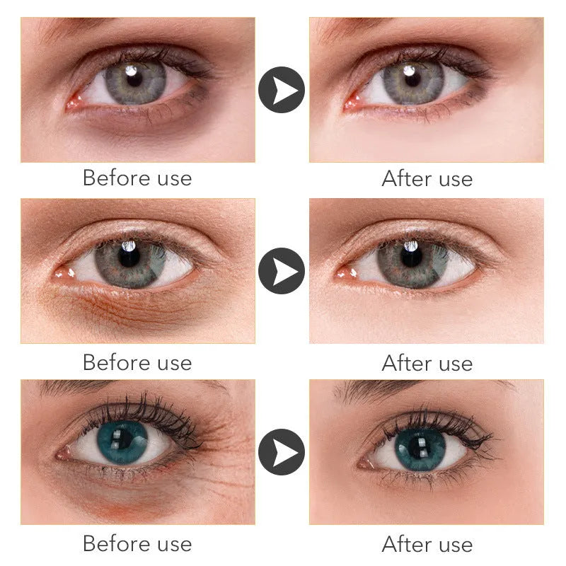 30ml jar of beauty eye cream for women's skincare focused on the delicate eye area
