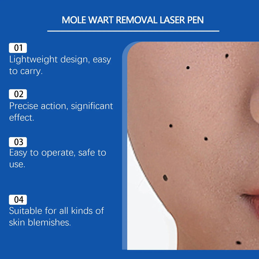 Mole wart removal laser pen with ABS plastic construction for at-home skin treatment