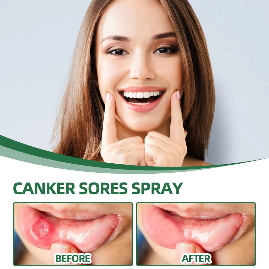 Boxed 20ml mint breath freshener spray bottle for adult oral care.