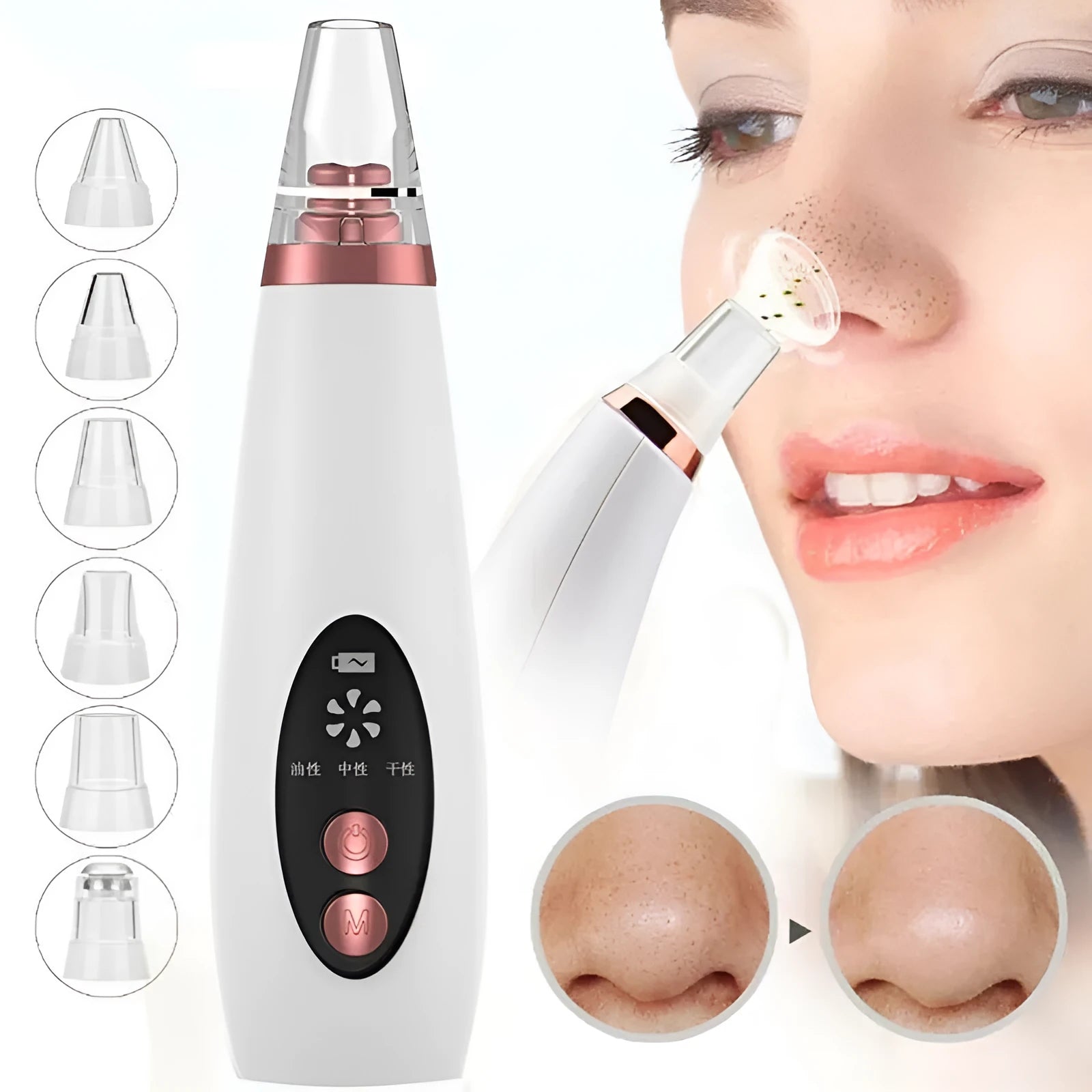 Blackhead Pore Vacuum Cleaner Nose Cleanser Blackheads Remover Blackhead Acne Removal Button Face Suction Beauty Skin Care Tool USB Rechargeable 53kPa Suction White