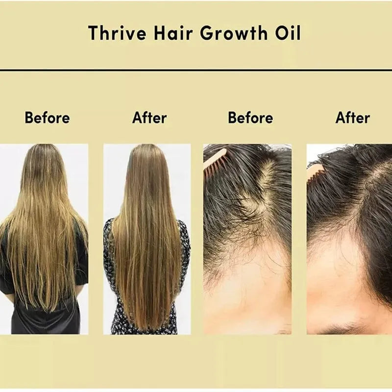 Yellow rosemary essential hair oil bottle 60ml for damaged hair treatment