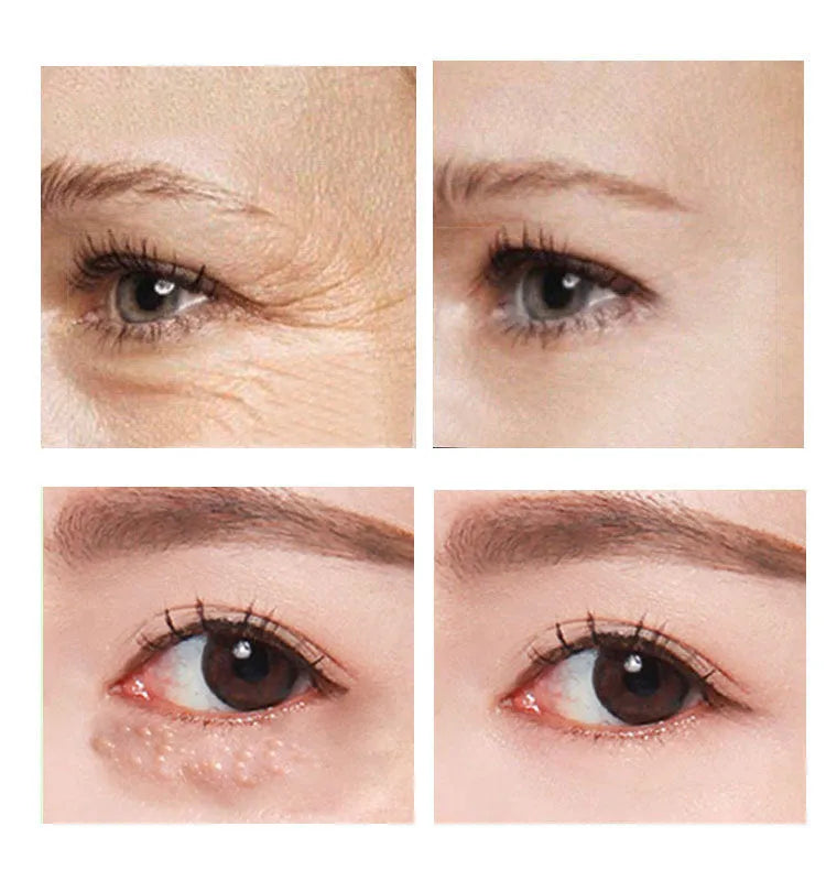 30ml jar of beauty eye cream for women's skincare focused on the delicate eye area
